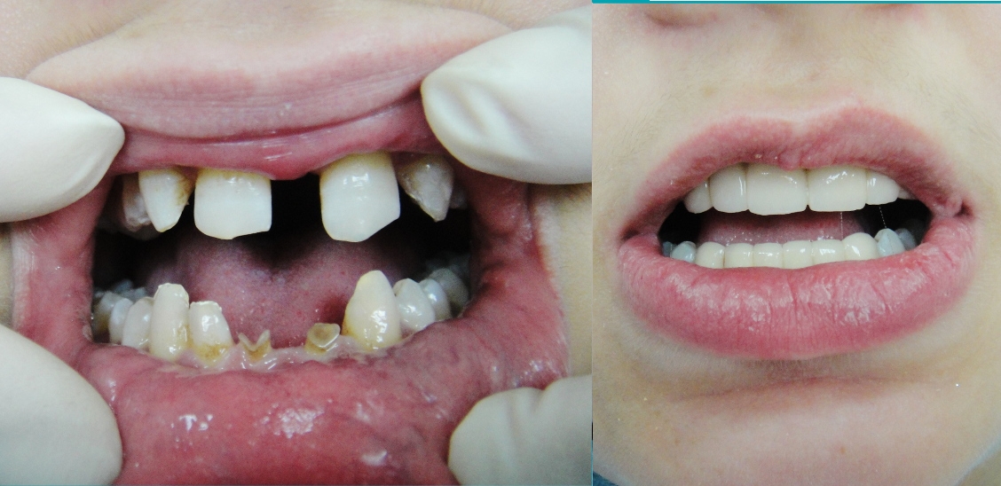 -краткое описание